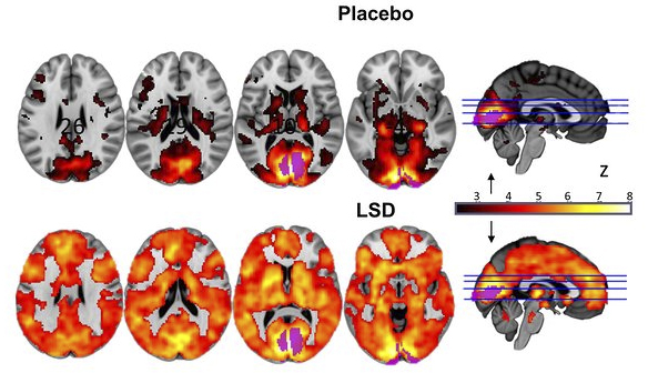 Images of real-time scans of a brain under the influence of LSD 25.